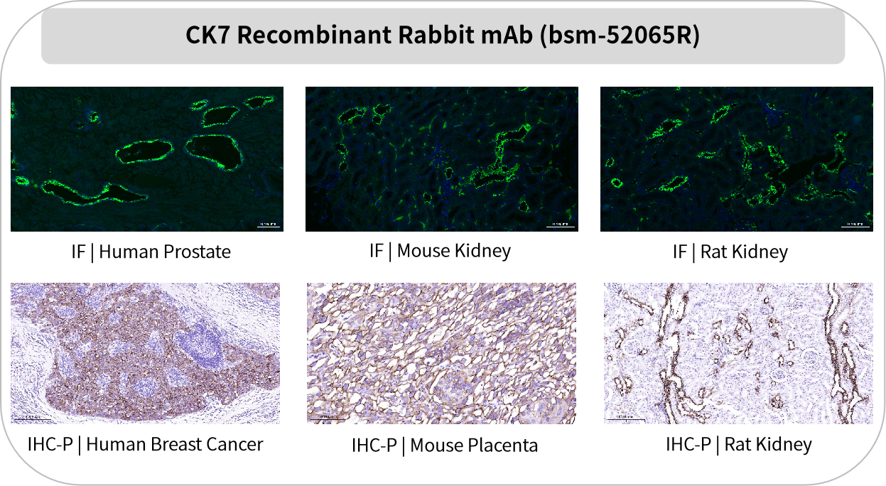 Bioss 爆品推荐 | 谁是“上皮组织”的忠实管家?CK抗体:找我,准没错!