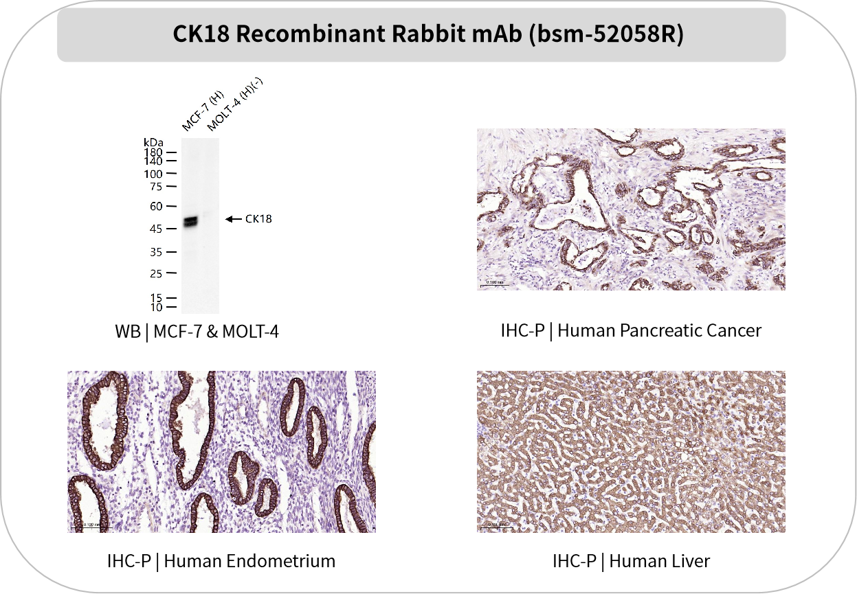 Bioss 爆品推荐 | 谁是“上皮组织”的忠实管家?CK抗体:找我,准没错!