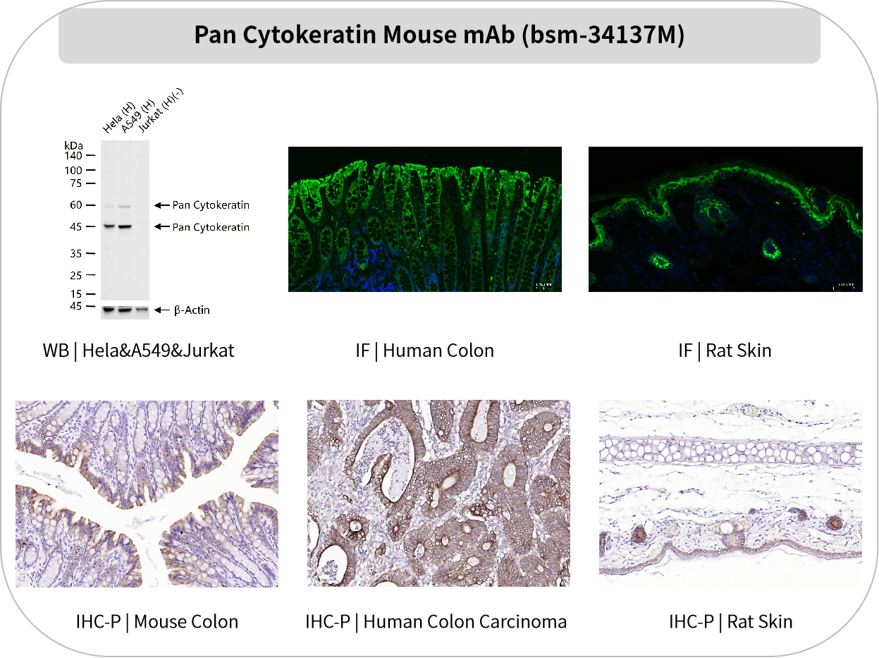 Bioss 爆品推荐 | 谁是“上皮组织”的忠实管家?CK抗体:找我,准没错!