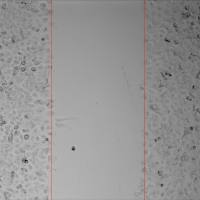 细胞功能/细胞划痕实验