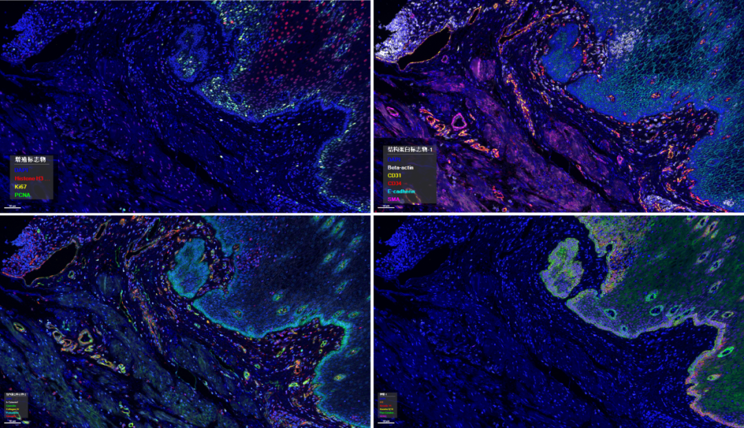 PCF固定panel限时【立减2万起】-肿瘤免疫