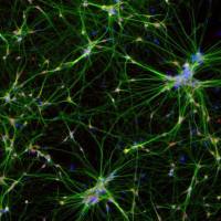 Invitrogen A21203 Donkey anti-Mouse IgG (H+L) Highly Cross-Adsorbed Secondary Antibody, Alexa Fluor™ 594