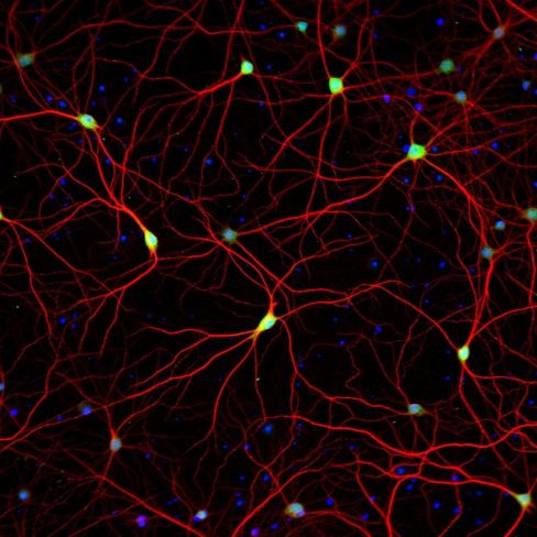 Invitrogen A21202 ALEXA FLUOR 488 DONKEY 1 MG抗体