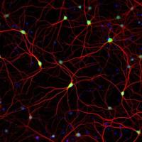 Invitrogen A21202 ALEXA FLUOR 488 DONKEY 1 MG抗体