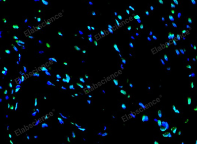 TUNEL检测细胞凋亡原理