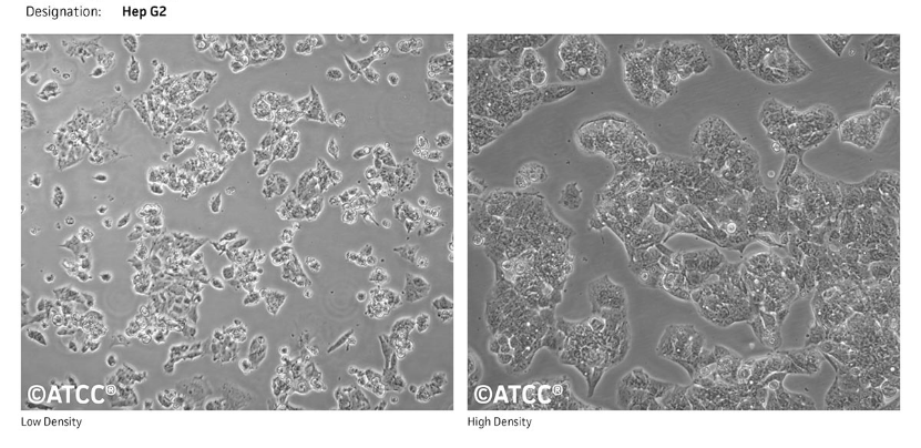 HepG2、SMMC-7721、Hep3B、Huh-7肝癌细胞系培养合集来袭！