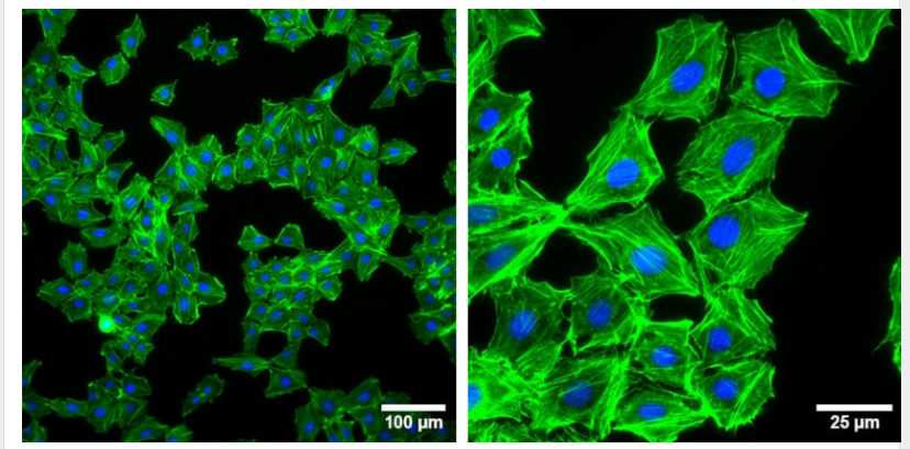 德国ibidi µ-Plate 12 Well共聚焦12孔培