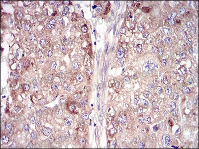 佰乐博生物蛋白抗体之——干细胞培养重组基质蛋白