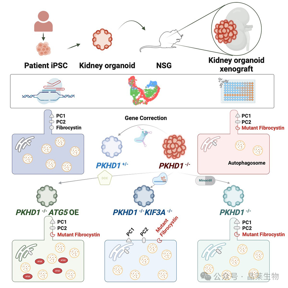 类器官热点研究 | 肾脏类器官模型揭示纤毛-自噬代谢轴作为多囊肾病治疗靶点