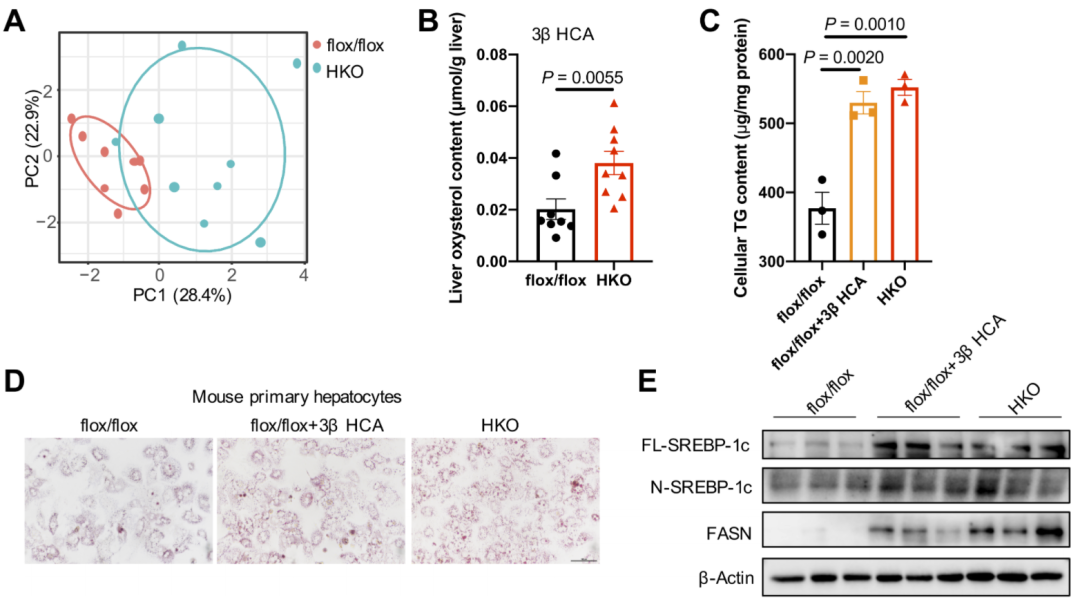 【AAV在肝脏疾病中的应用】上海交大医学院胡承/陆炎研究员团队揭示肝脏IL22RA1通过氧化甾醇3βHCA调控肝脂肪变性的机制