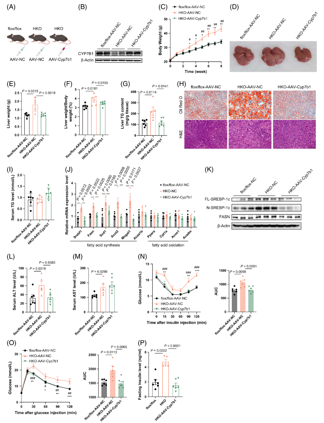 【AAV在肝脏疾病中的应用】上海交大医学院胡承/陆炎研究员团队揭示肝脏IL22RA1通过氧化甾醇3βHCA调控肝脂肪变性的机制