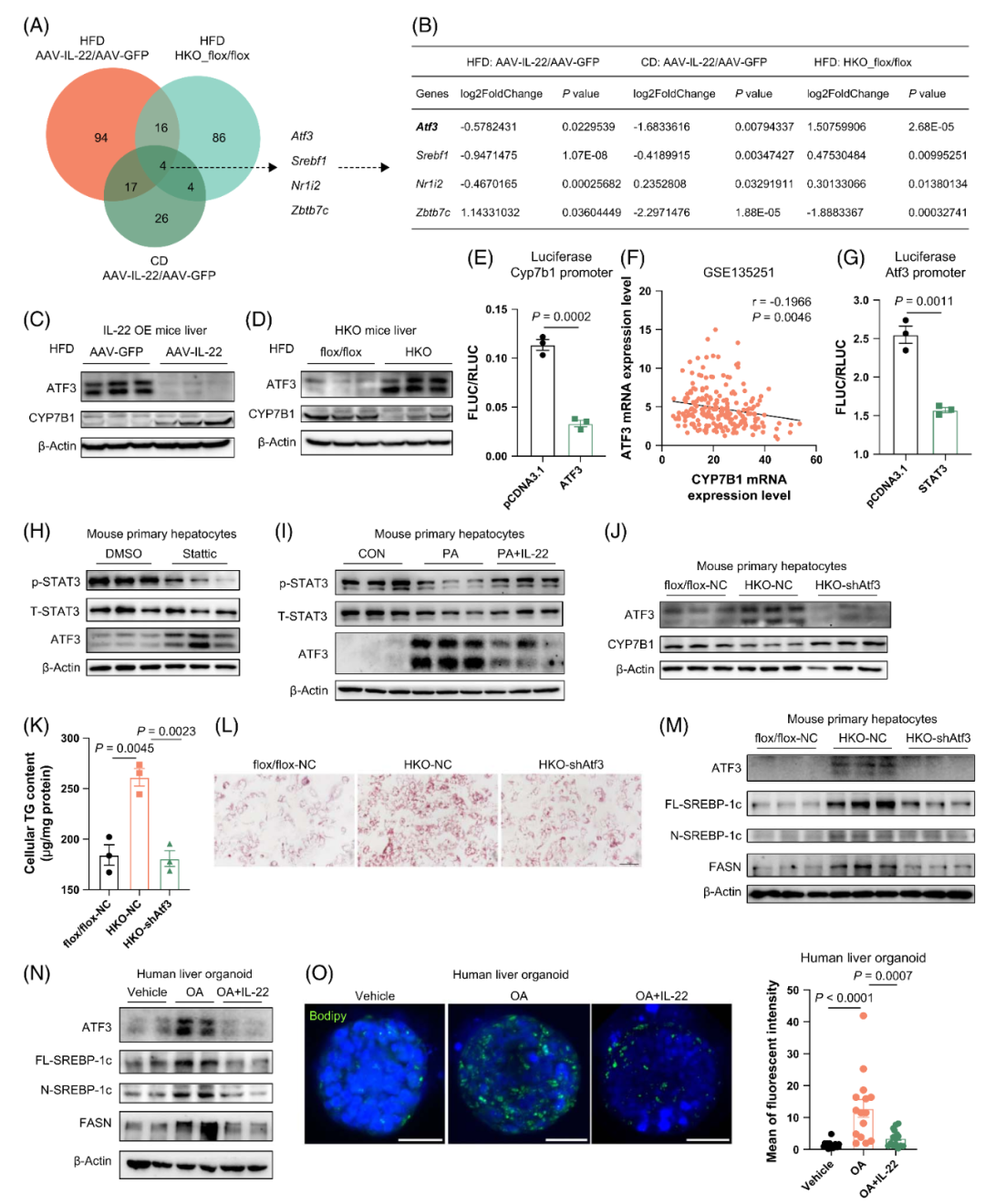 【AAV在肝脏疾病中的应用】上海交大医学院胡承/陆炎研究员团队揭示肝脏IL22RA1通过氧化甾醇3βHCA调控肝脂肪变性的机制