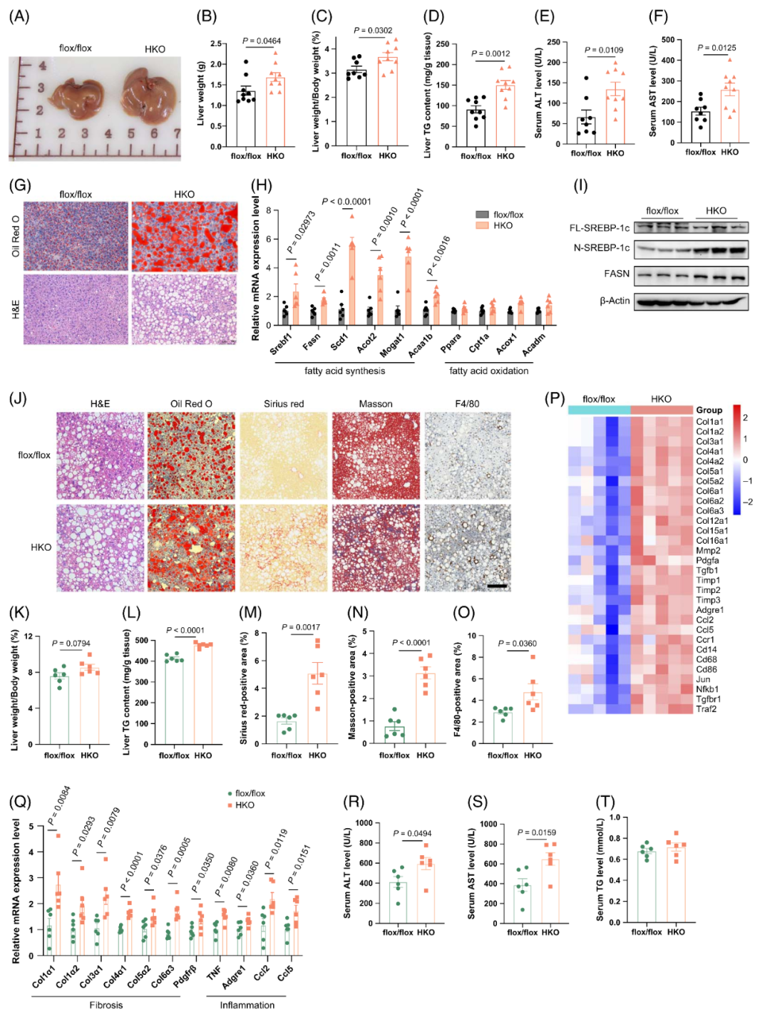 【AAV在肝脏疾病中的应用】上海交大医学院胡承/陆炎研究员团队揭示肝脏IL22RA1通过氧化甾醇3βHCA调控肝脂肪变性的机制