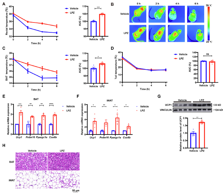 【文献解读】老药新用:兰索拉唑通过抑制PHOSPHO1改善代谢综合征的研究