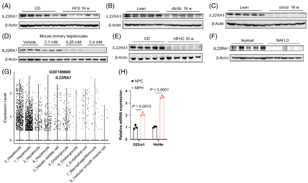 【AAV在肝脏疾病中的应用】上海交大医学院胡承/陆炎研究员团队揭示肝脏IL22RA1通过氧化甾醇3βHCA调控肝脂肪变性的机制
