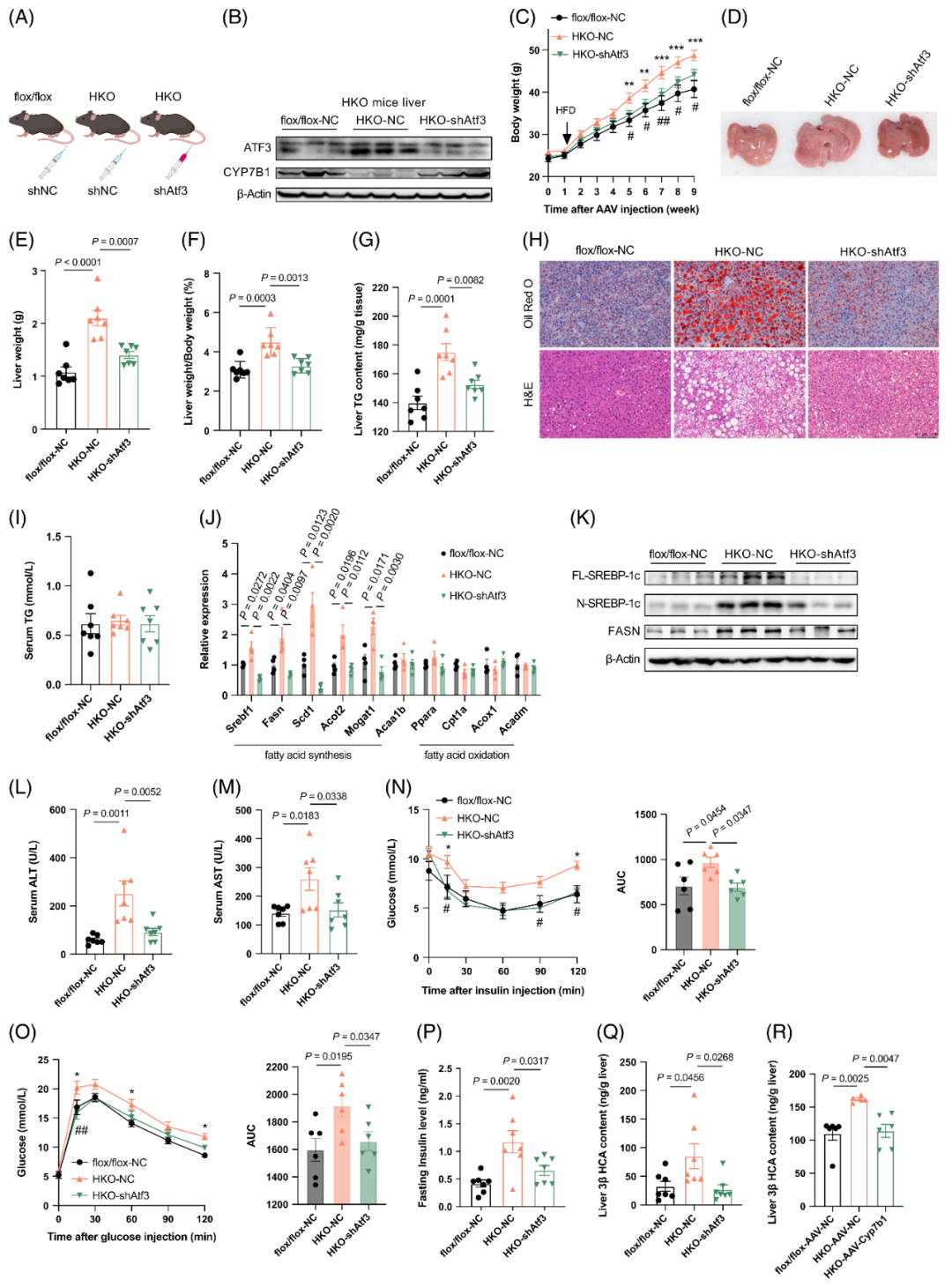 【AAV在肝脏疾病中的应用】上海交大医学院胡承/陆炎研究员团队揭示肝脏IL22RA1通过氧化甾醇3βHCA调控肝脂肪变性的机制