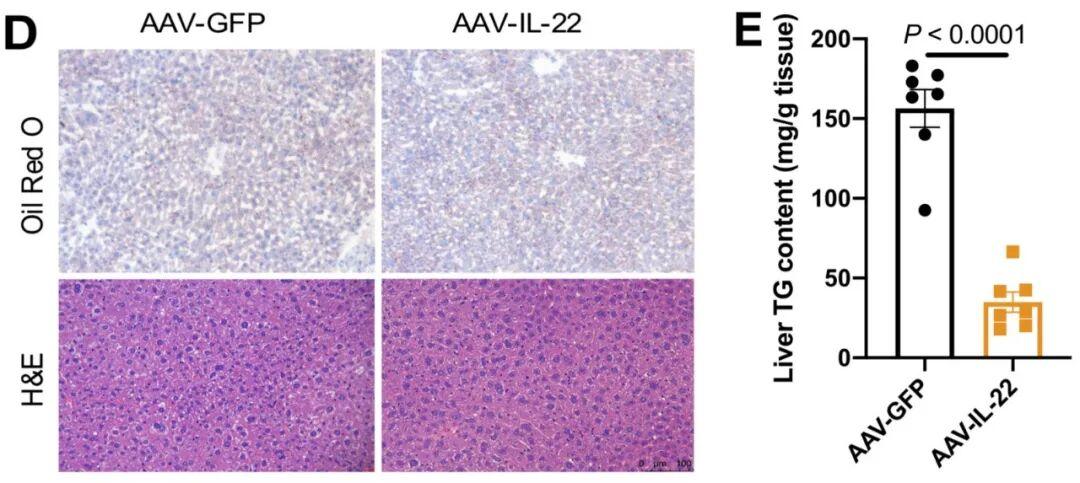 【AAV在肝脏疾病中的应用】上海交大医学院胡承/陆炎研究员团队揭示肝脏IL22RA1通过氧化甾醇3βHCA调控肝脂肪变性的机制