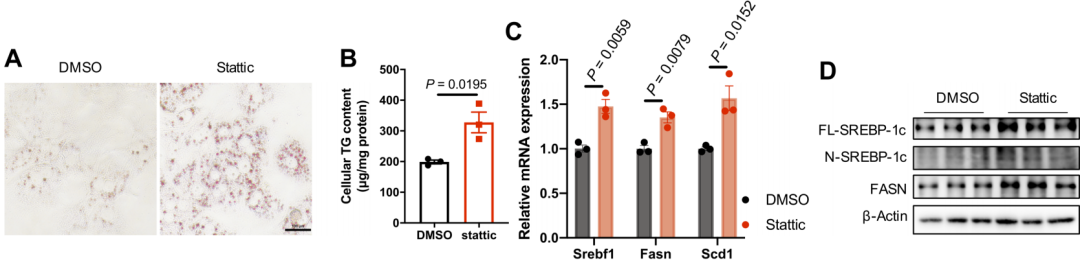 【AAV在肝脏疾病中的应用】上海交大医学院胡承/陆炎研究员团队揭示肝脏IL22RA1通过氧化甾醇3βHCA调控肝脂肪变性的机制