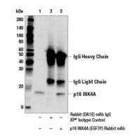 p16 INK4A (E5F3Y) Rabbit mAb