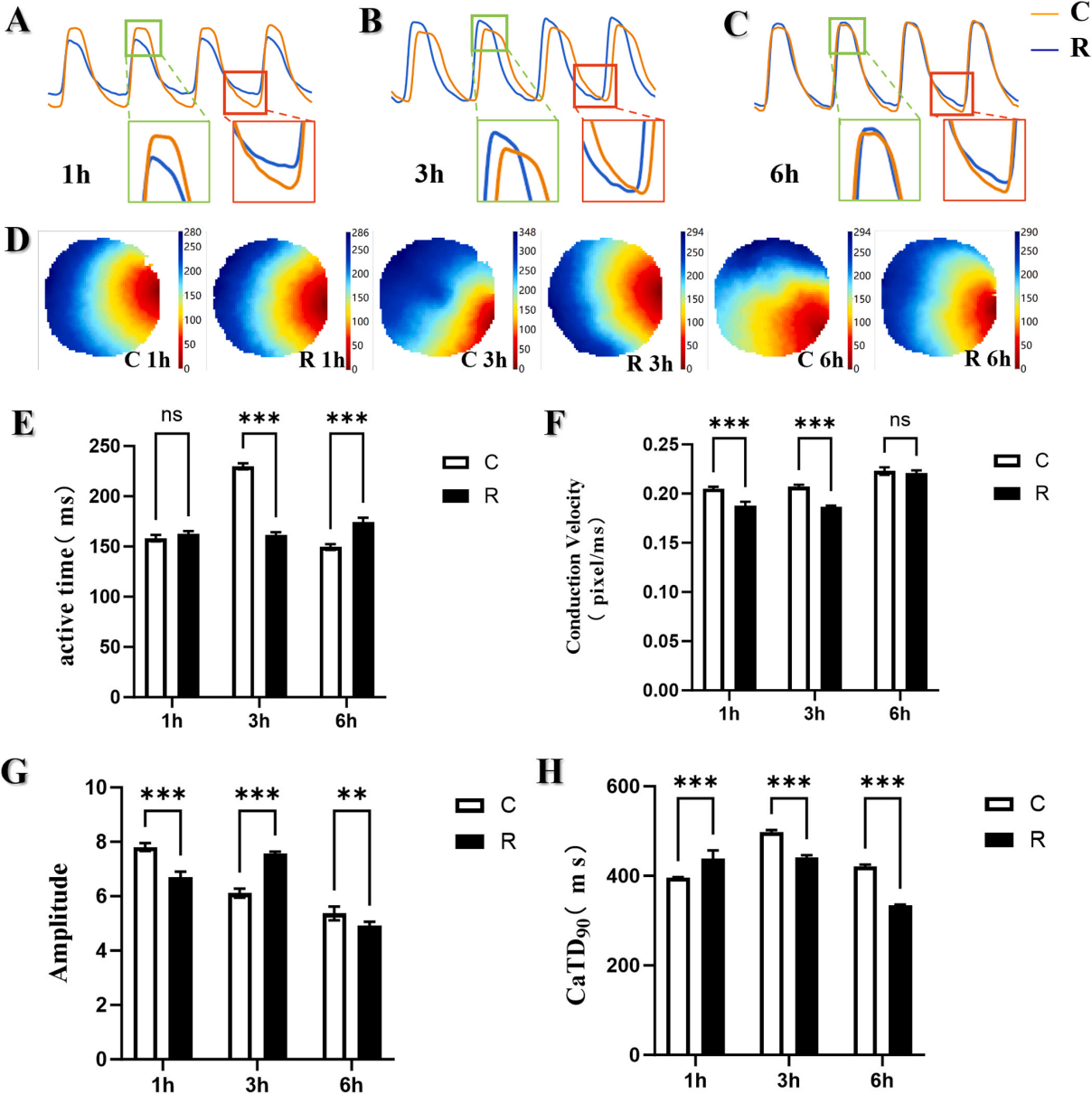 微波辐射诱导iPSC-CMs中NF-κB介导的自主炎症反应的时间研究