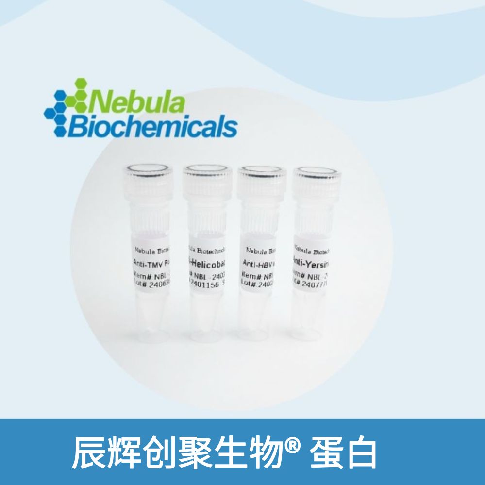 Recombinant HIV-2 gag p26 antigen