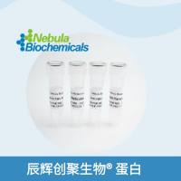 HIV-2 gag p26抗原蛋白 | Recombinant HIV-2 gag p26 antigen