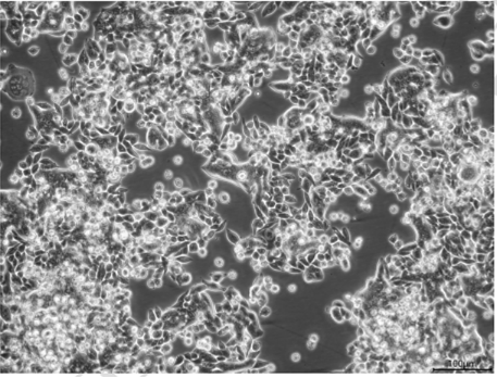 HCT116、HT-29、SW620、LoVo结肠癌细胞系培养合集来袭！