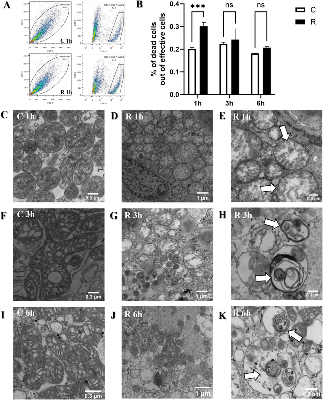 微波辐射诱导iPSC-CMs中NF-κB介导的自主炎症反应的时间研究