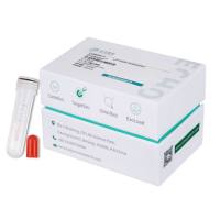 0元试用-Exosupur®外泌体纯化袖珍柱--游离示踪染料、荧光抗体、小分子去除、二次纯化提升电镜效果