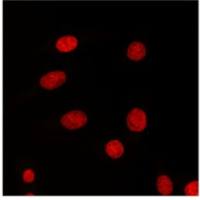 CD45 (D3F8Q) Rabbit mAb