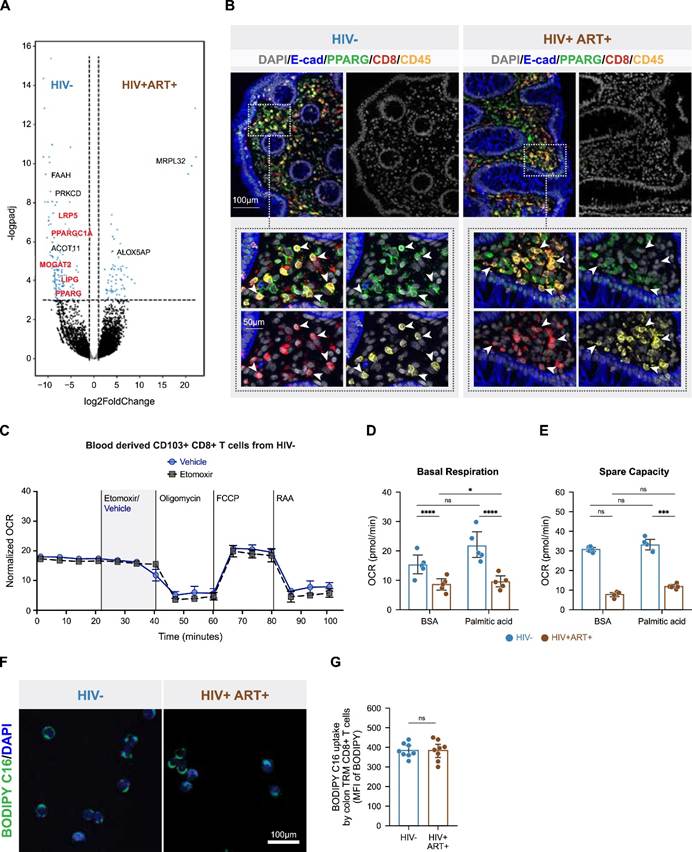 Cell | Tissue Cytometry 技术捕捉 HIV 肠道细胞互作,见证 CD8+T 细胞免疫代谢缺陷如何破坏肠屏障