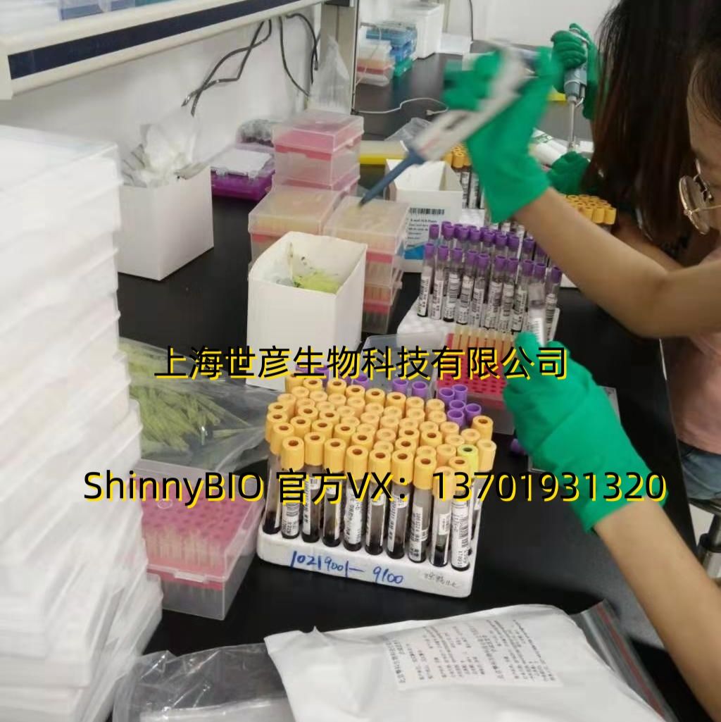 人补体检测7项ELISA检测试剂盒