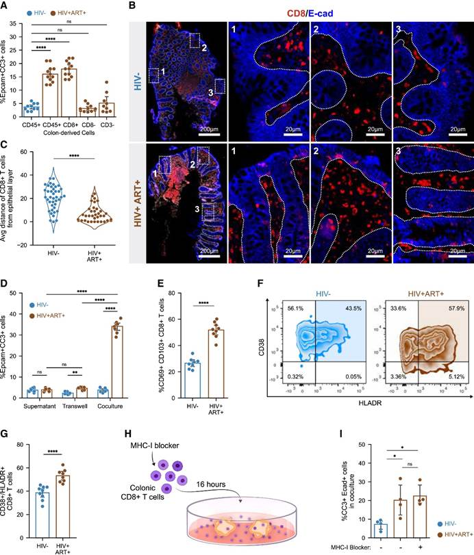 Cell | Tissue Cytometry 技术捕捉 HIV 肠道细胞互作,见证 CD8+T 细胞免疫代谢缺陷如何破坏肠屏障