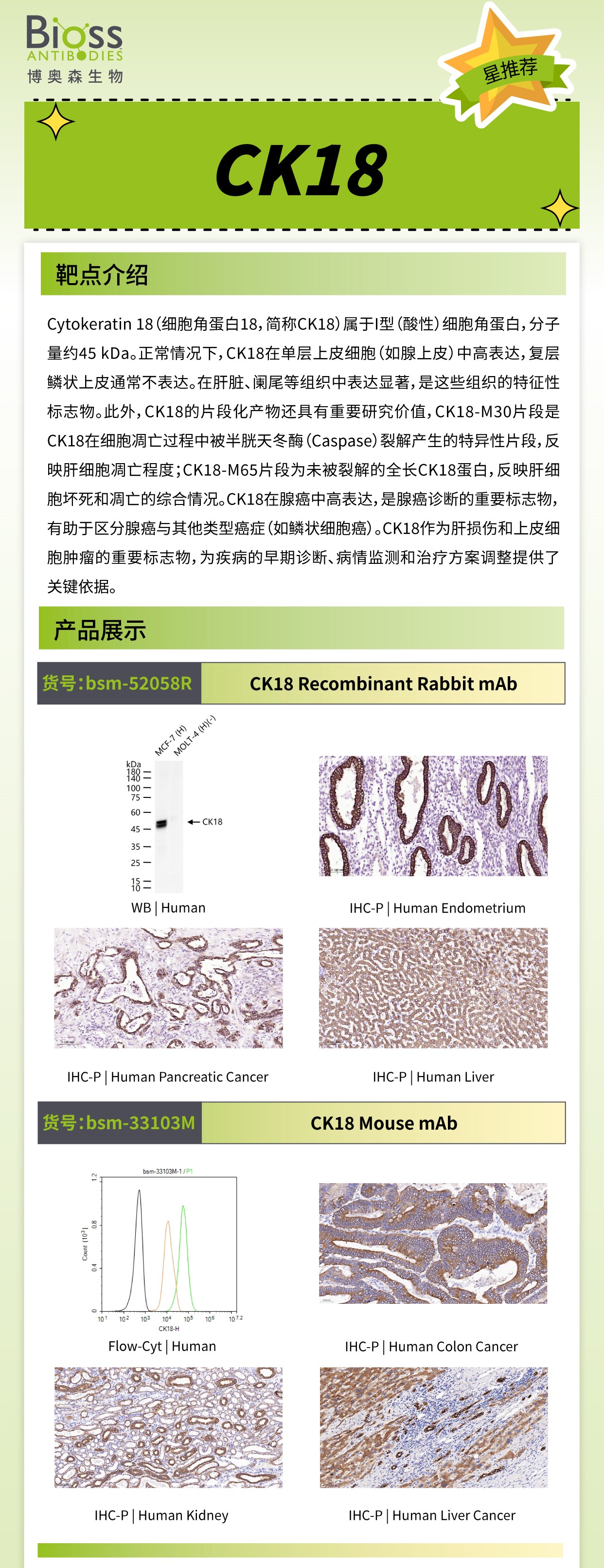 Bioss 星推荐 | CK18 抗体
