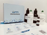 GLUT-1 Recombinant Rabbit mAb (Alexa Fluor® 594 Conjugate) (SDT-047-53)