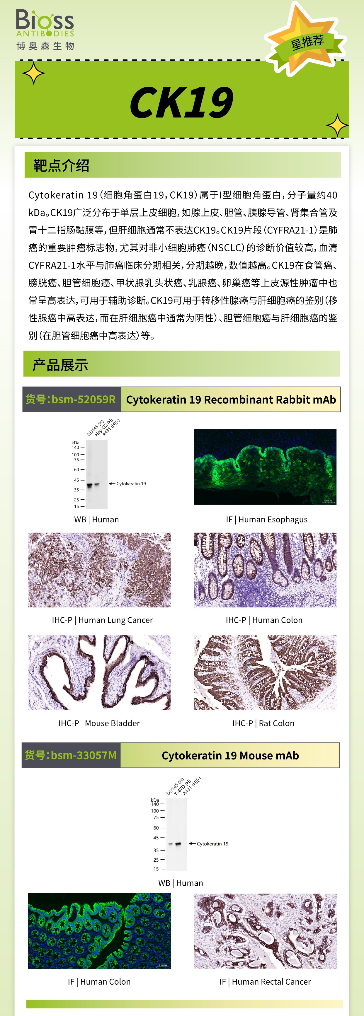 Bioss 星推荐 | CK19 抗体