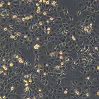 浙江美森-人食道癌肿瘤细胞COLO680N