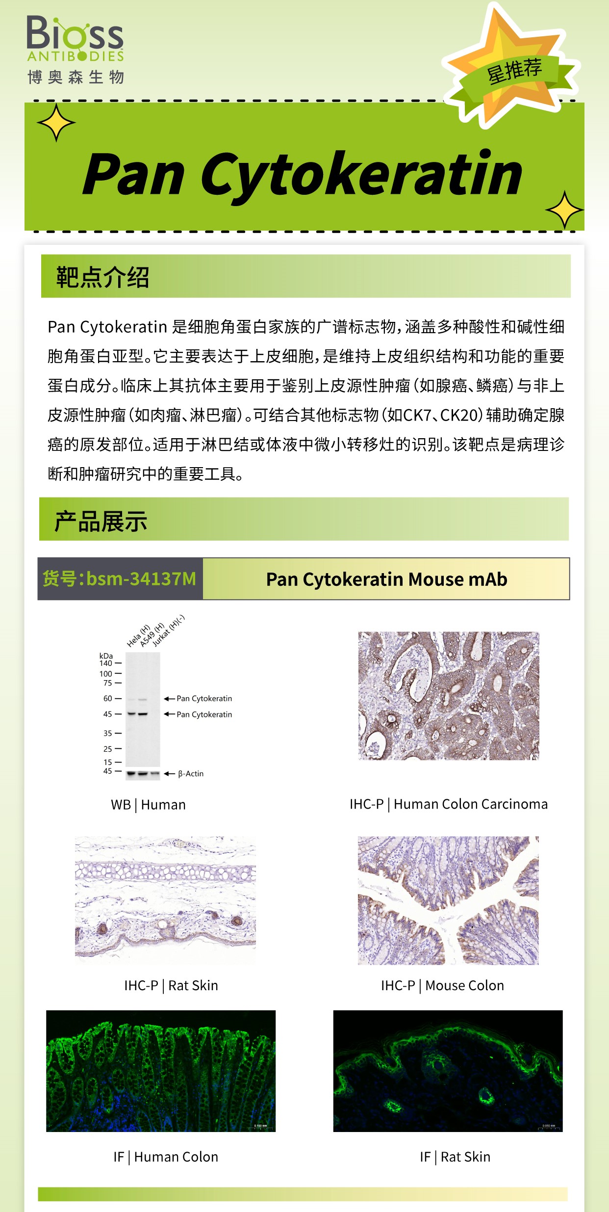 Bioss 星推荐 | Pan Cytokeratin 抗体