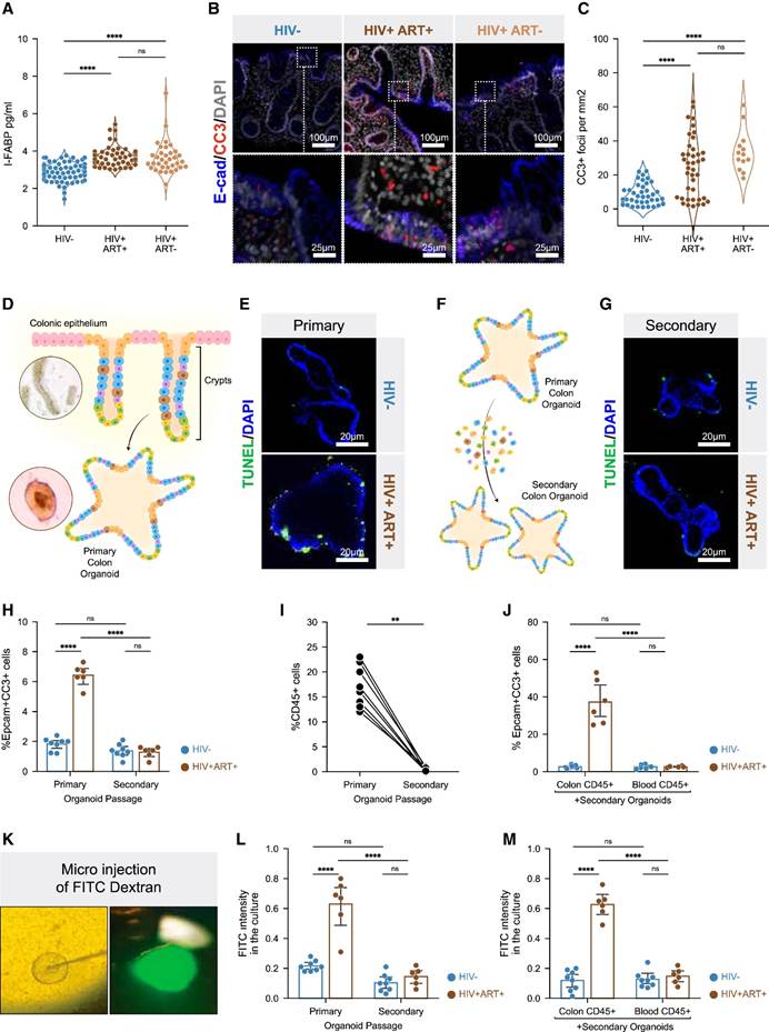 Cell | Tissue Cytometry 技术捕捉 HIV 肠道细胞互作,见证 CD8+T 细胞免疫代谢缺陷如何破坏肠屏障