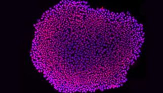 hPSC诱导心脏类器官培养攻略