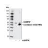 SQSTM1/p62 Antibody