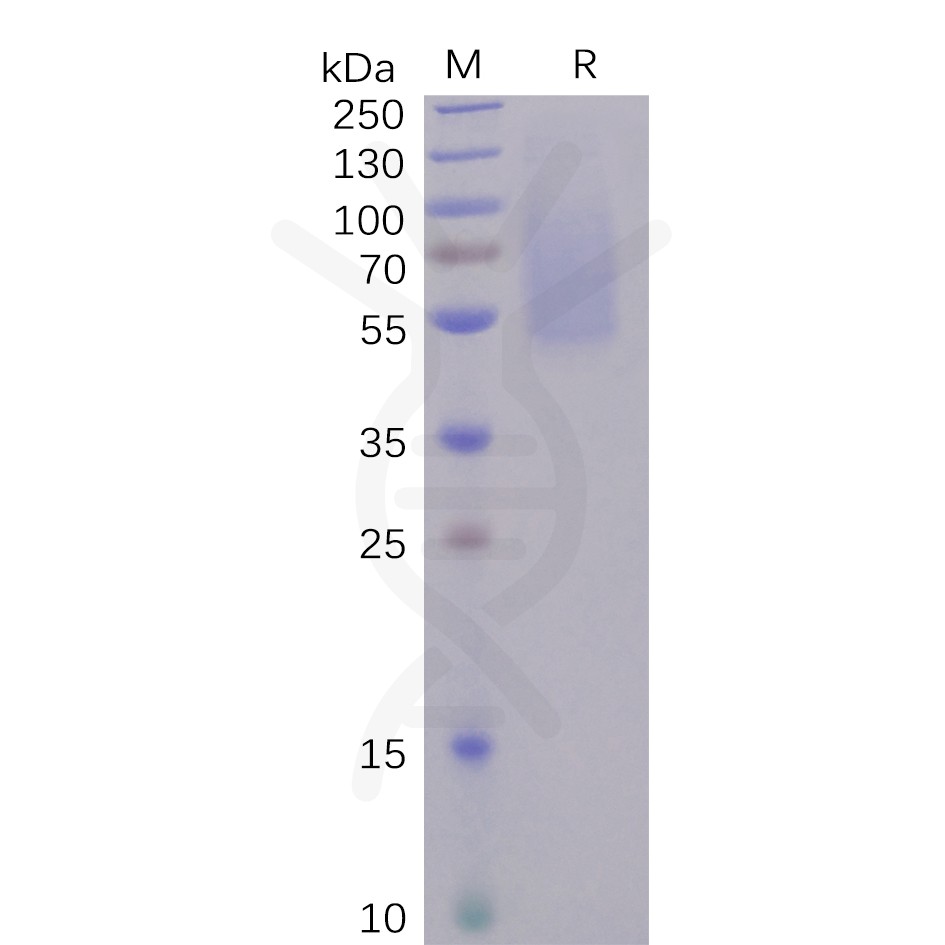 pme100491-s1-protein-ntd-sp1.jpg