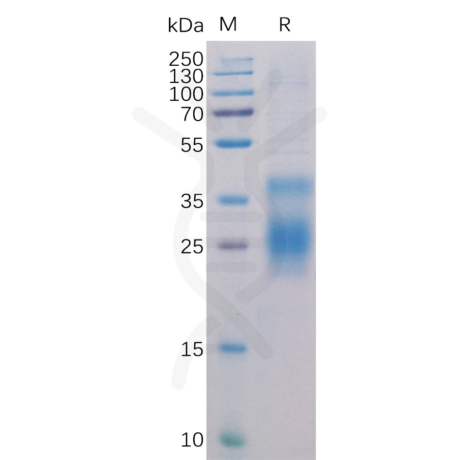 pme100273-hvem-sp1.jpg