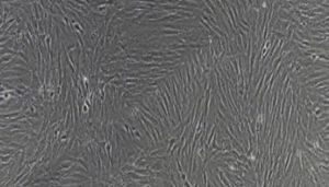 大鼠原代大隐静脉平滑肌细胞