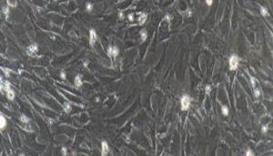 大鼠原代肾动脉平滑肌细胞