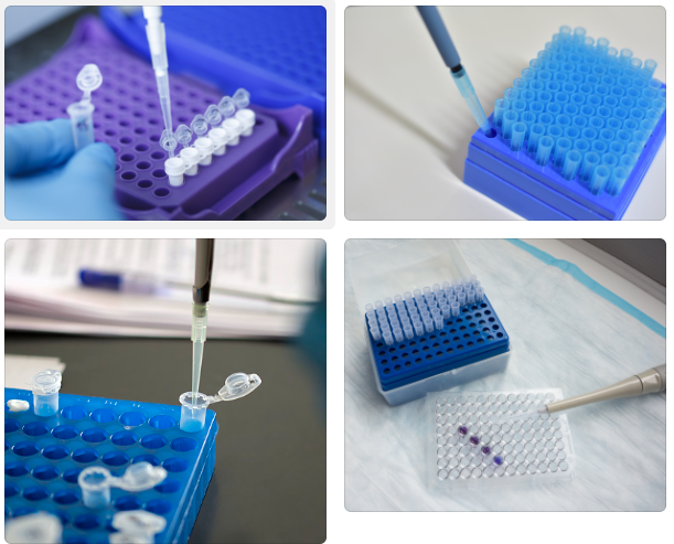 如何判断抗体样本是否存在过度混匀