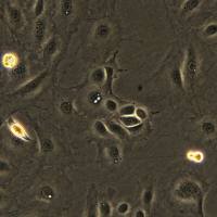 浙江美森-人肝癌细胞 SNU-182