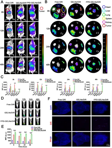 体内成像 体内成像
