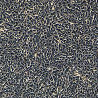 浙江美森-人甲状腺乳头状细胞