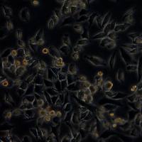 浙江美森-人胰腺导管癌细胞 MIA PaCa-2